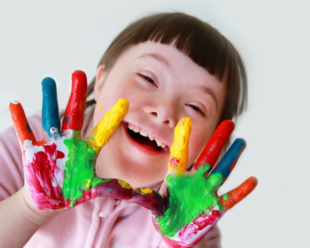 down syndrome